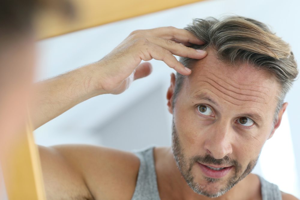 Why Your Parents Could Be to Blame for Male Pattern Baldness