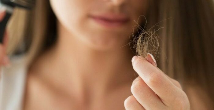 New Hair Clinic what causes hairloss