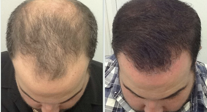 New Hair Clinic