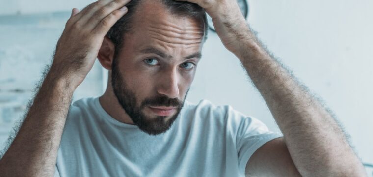 Hair Loss