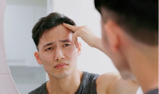 Experiencing Thinning Hair? Uncover the Reasons Behind It