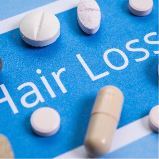 hair loss 1