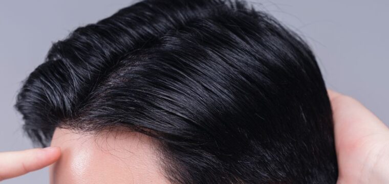 hairline