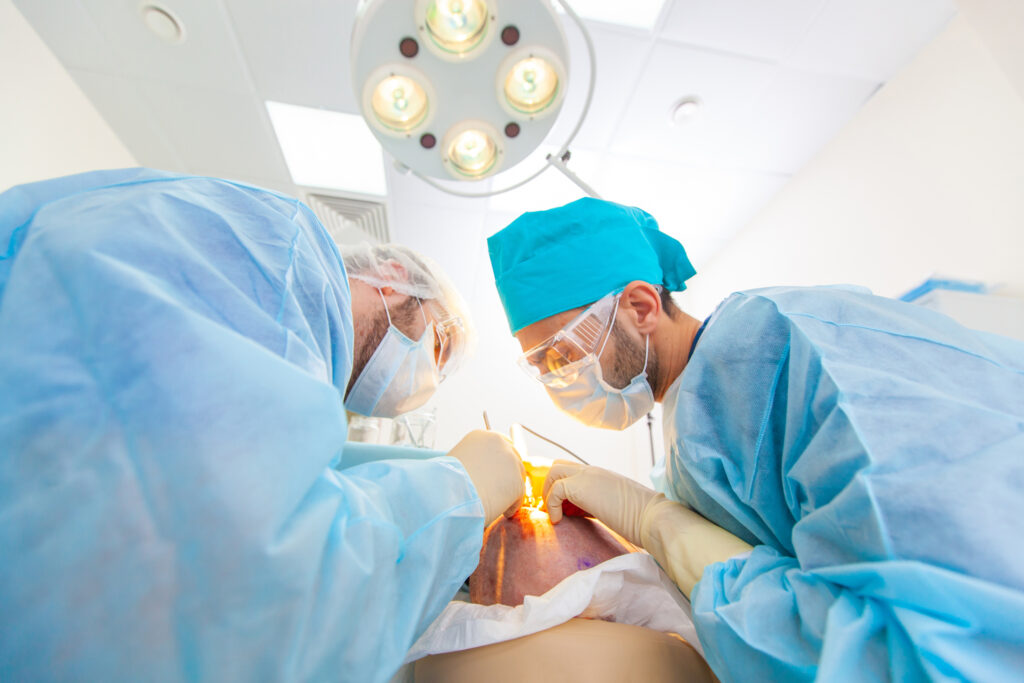 How-Does-Revision-Hair-Transplant-Surgery-Work