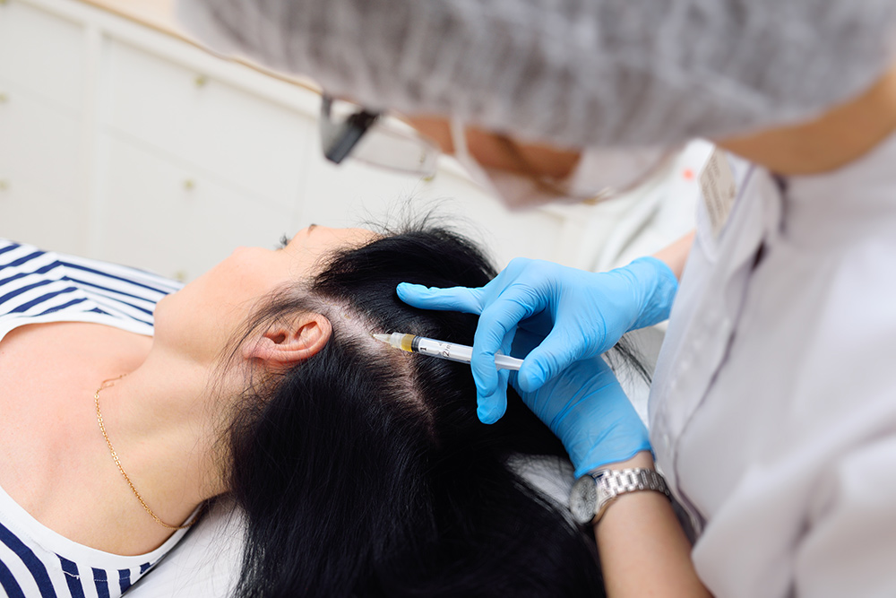 Platelet Rich Plasma PRP For Hair Loss | Thinning Hair | Male Pattern Baldness | Female Pattern Baldness | New Hair Clinic Perth