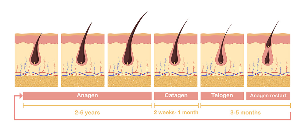 Hair Growth Cycle | Types of Hair Loss in Women | Treatment for Hair Loss | New Hair Clinic Perth