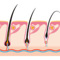 What Are The Stages Of Hair Growth | Natural Hair Growth Cycle | Hair Cycle Explained | New Hair Clinic Perth