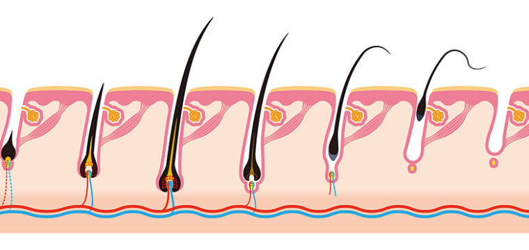 What Are The Stages Of Hair Growth | Natural Hair Growth Cycle | Hair Cycle Explained | New Hair Clinic Perth