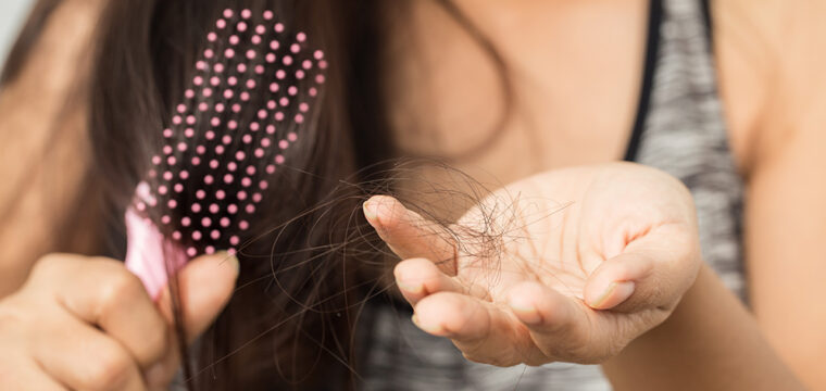What Causes Hair Loss In Women | Cause Of Hair Loss | Types of Hair Loss for Women | New Hair Clinic Perth