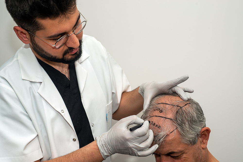 Hair Fall in Men & Women | Causes of Hair Loss & Thinning Hair | Hair Loss Treatment | Male Pattern Baldness | Female Pattern Baldness | New Hair Clinic Perth
