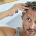 When to Get Hair Transplant | Hair Transplantation | FUE Hair Transplant Procedure | New Hair Clinic Perth