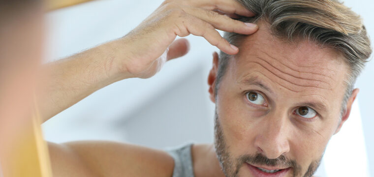 When to Get Hair Transplant | Hair Transplantation | FUE Hair Transplant Procedure | New Hair Clinic Perth