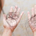 Why Is My Hair Falling Out | Causes of Hair Fall | Hair Fall in Females | Hair Fall in Men | New Hair Clinic Perth