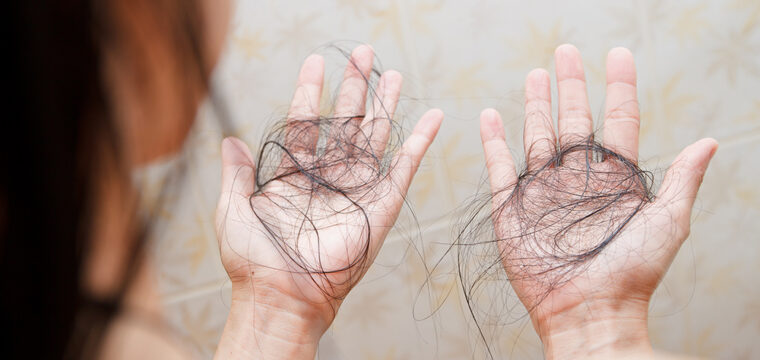 Why Is My Hair Falling Out | Causes of Hair Fall | Hair Fall in Females | Hair Fall in Men | New Hair Clinic Perth