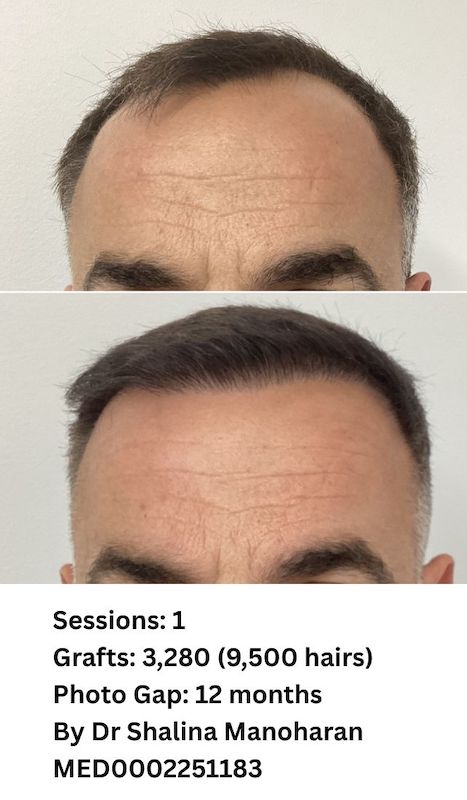 NHC B&A Photos June 2026 - 11