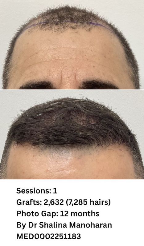 NHC B&A Photos June 2026 - 9